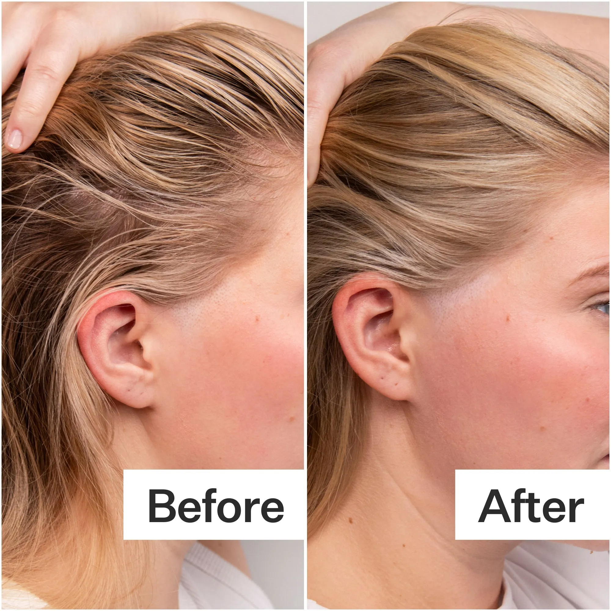 Act Acre 4% Niacinamide Oily Scalp Serum