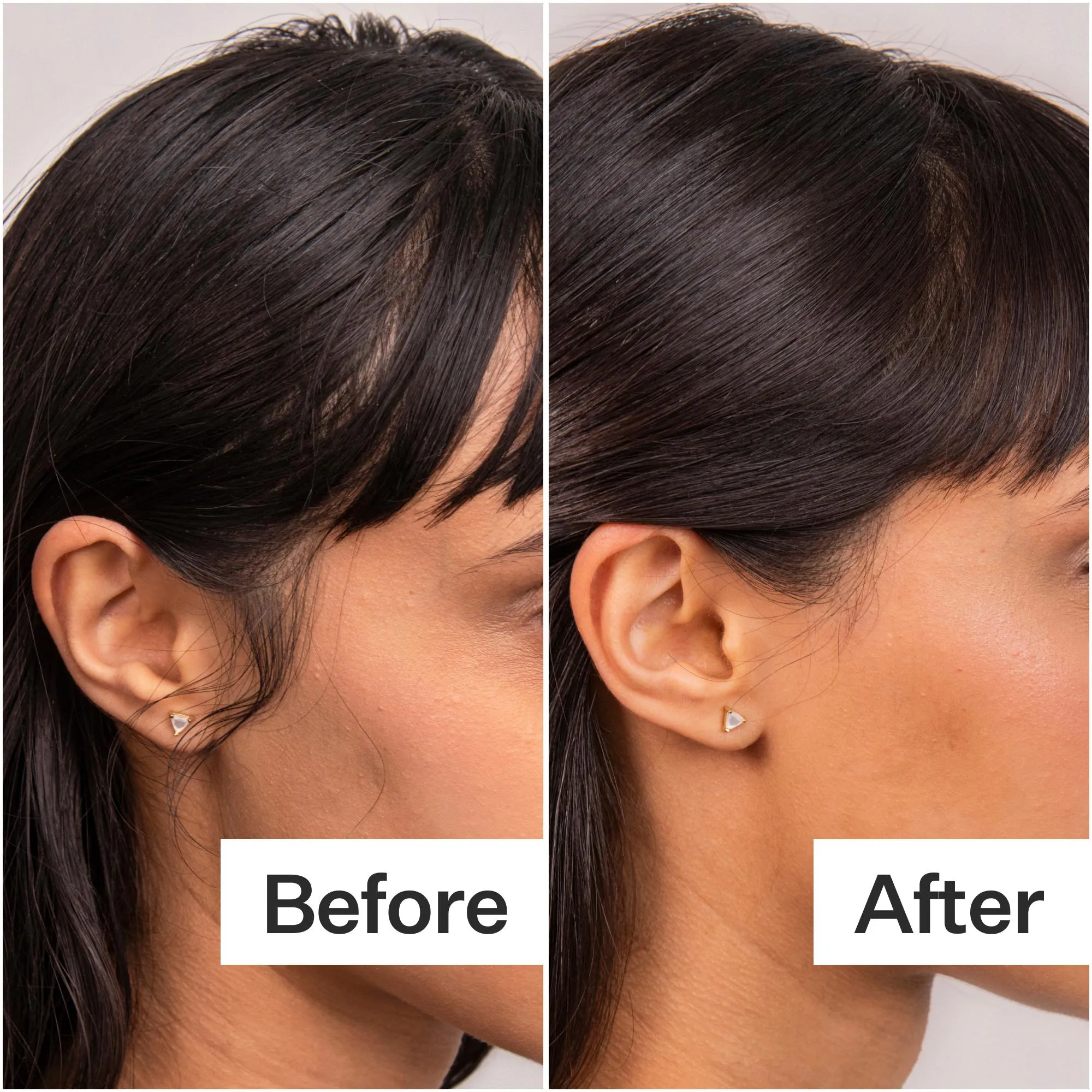 Act Acre 4% Niacinamide Oily Scalp Serum